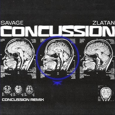 Savage-Zlatan-Concussion-Remix